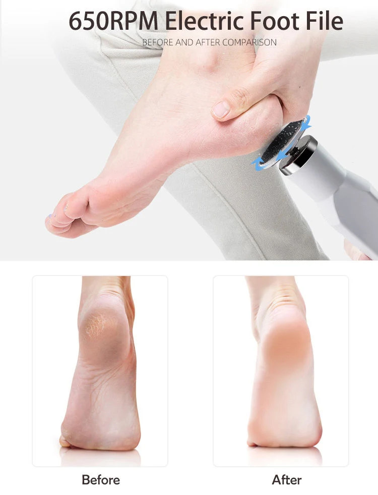 650 Rpm Rechargeable Electric Foot Scrubber Callus Remover
